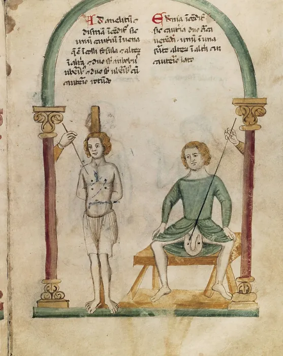 Framed Print : Cauterization and preparation. Miniature. Ms.Rawlinson C 328 fol. 9r. Miniature Painting. UNITED KINGDOM. Oxford. Bodleian Library. AISA / Everett Collection**US SALES ONLY** Framed Print : Cauterization and preparation. Miniature. Ms.Rawlinson C 328 fol. 9r. Miniature Painting. UNITED KINGDOM. Oxford. Bodleian Library. AISA / Everett Collection**US SALES ONLY**