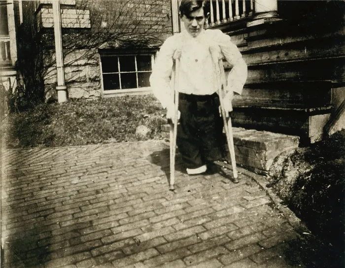 Framed Print : Child Labor, Frank, whose legs were cut off by a motor car in a coal mine in West Virginia when he was 14 years, 10 months of age, West Virginia, photograph by Lewis Wickes Hine