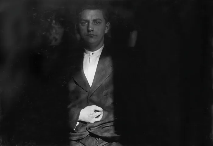 Framed Print : Child labor, Frank Wiegel, of Brooklyn, injured after working 18 hours a day at 15 years old, two fingers were amputated off of his right hand