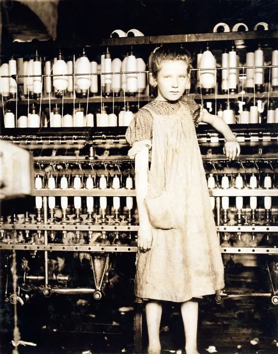 Framed Print : Child laborer portrayed by Lewis Hine in 1910. Twelve year old Addie Card, was a spinner in a Vermont cotton mill, and did not plan to go back to school