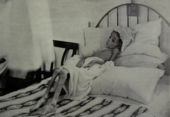 Framed Print : Child victim of starvation in Cuba during the Cuban War of Independence, 1895-1898