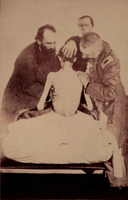 Framed Print : The Civil War, Doctors examining a Federal prisoner returned from prison, photograph circa 1861-1865