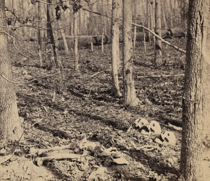 Framed Print : US Civil War. The Overland Campaign, The Wilderness, May 5-7, 1864. Skulls and bones of unburied soldiers in the woods after the Wilderness battle