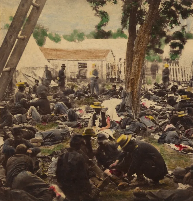 Framed Print : US Civil War, Peninsula Campaign, Seven Days Battles, June 25-July 1, 1862. Wounded Union soldiers crowded in a field hospital at Savage's Station, Virginia