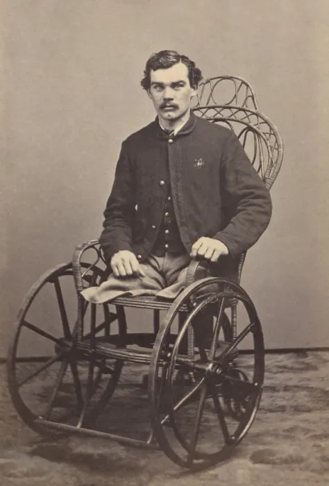 Framed Print : Corporal Michael Dunn of Co. H, 46th Pennsylvania Infantry Regiment, lost both of his legs in battle near Dallas, Georgia, on May 25, 1864 Framed Print : Corporal Michael Dunn of Co. H, 46th Pennsylvania Infantry Regiment, lost both of his legs in battle near Dallas, Georgia, on May 25, 1864