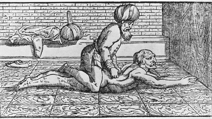 Framed Print : Doctor massaging a patient's back. Illustration from a European book, based on writings of Arab physician Avicenna (980?-1037) Framed Print : Doctor massaging a patient's back. Illustration from a European book, based on writings of Arab physician Avicenna (980?-1037)