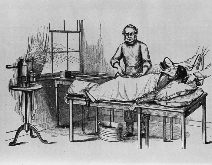 Framed Print : Doctor performing an ovariotomy, the removal of one or both ovaries, using anesthetic and antiseptic steam spray Framed Print : Doctor performing an ovariotomy, the removal of one or both ovaries, using anesthetic and antiseptic steam spray