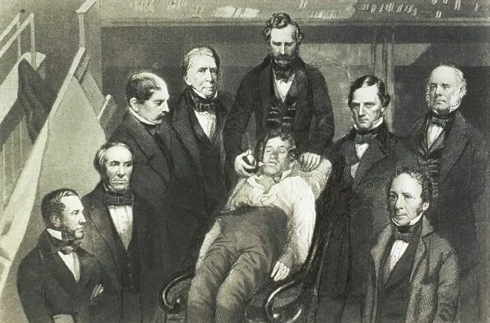 Framed Print : Dr. William T.G. Morton administering ether to a patient, Gilbert Abbott, who will undergo surgery for a tumor in the neck at Massachusetts General Hospital on October 16, 1846 Framed Print : Dr. William T.G. Morton administering ether to a patient, Gilbert Abbott, who will undergo surgery for a tumor in the neck at Massachusetts General Hospital on October 16, 1846