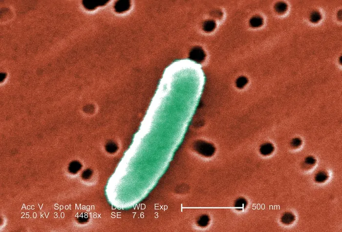 Framed Print : E. coli, a common cause of bacterial diarrhea. Colorized scanning electron micrograph (SEM). Photo by Janice Haney Carr, 2007