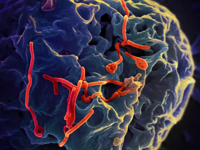 Framed Print : Ebola virus particles (red) on a larger cell Framed Print : Ebola virus particles (red) on a larger cell