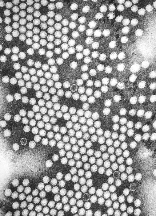 Framed Print : Electron micrograph of the poliovirus. 1975 Framed Print : Electron micrograph of the poliovirus. 1975