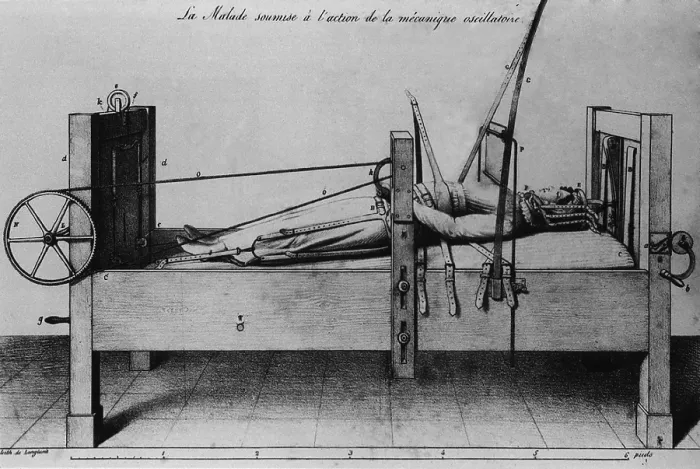 Framed Print : Female patient strapped into an orthopedic bed, with braces and cranks to apply traction. From 1827 French medical treatise