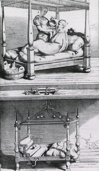 Framed Print : Fever Bag of the 17th century