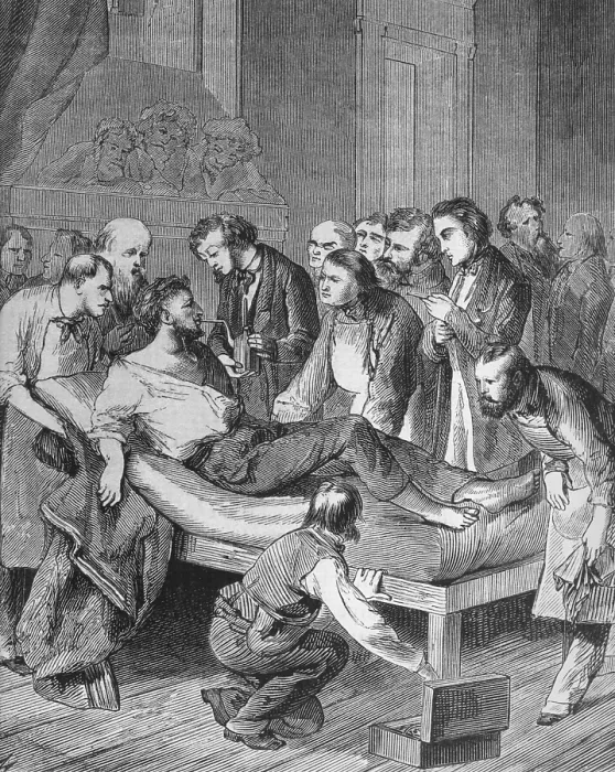 Framed Print : First administration of ether to a patient, Gilbert Abbott, about to undergo surgery for a tumor in the neck at Massachusetts General Hospital on October 16, 1846 Framed Print : First administration of ether to a patient, Gilbert Abbott, about to undergo surgery for a tumor in the neck at Massachusetts General Hospital on October 16, 1846
