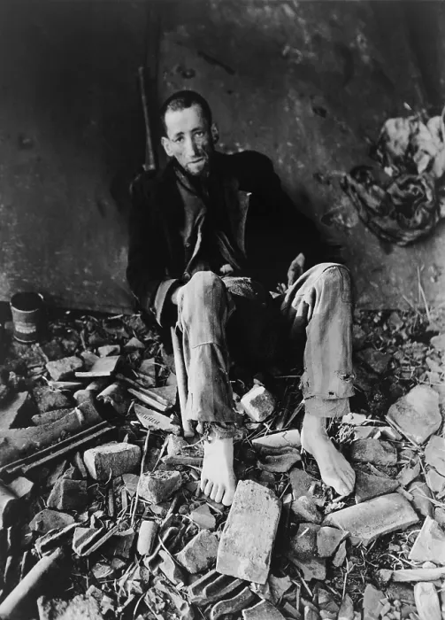 Framed Print : French prisoner at Nordhausen Concentration camp amid prison rubble waiting for an ambulance to take him to a hospital after liberation by First U.S. Army on April 11, 1945