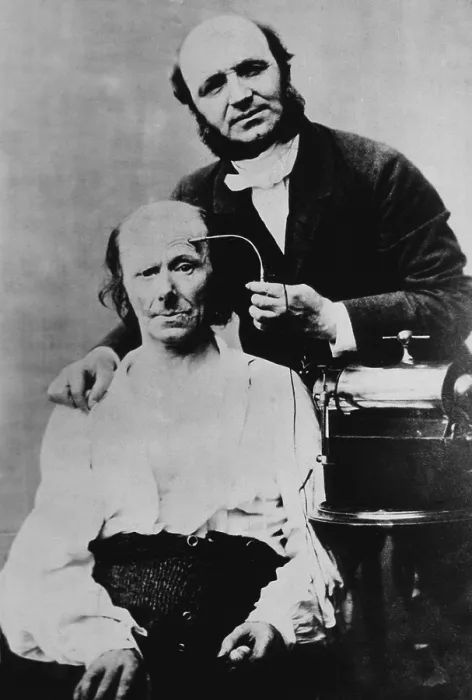 Framed Print : Guillaume Duchenne (1806-1875), French physician, conducted experiments in electricity's effect on muscles