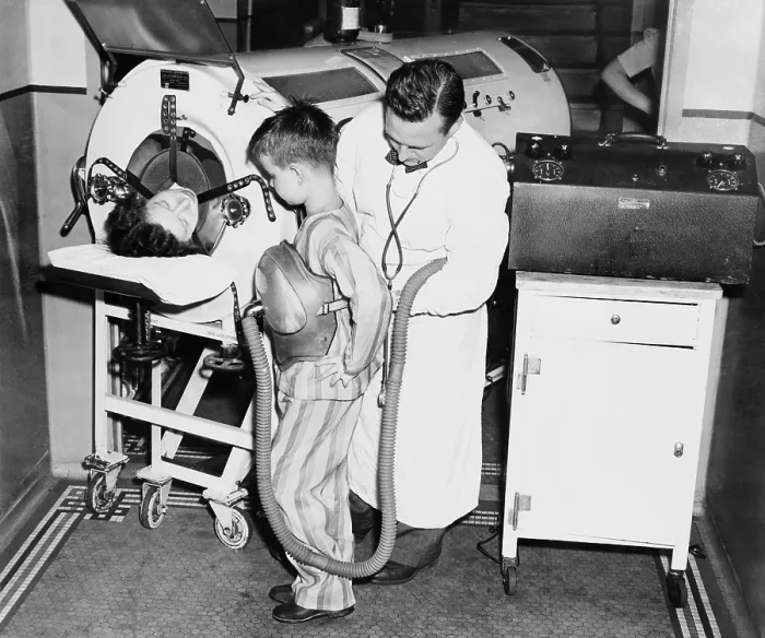 Framed Print : At the height of a polio epidemic, Dr. Harry Seanor, fastens the one pound lung on an eight year old boy, to show the difference in size to that of the 700 pound lung at left