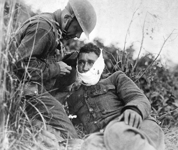 Framed Print : A just wounded American soldier, receiving first-aid treatment from a comrade. World War I. Varennes-en-Argonne, France. Sept. 26, 1918