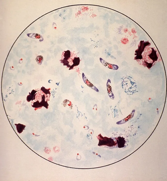 Framed Print : Microscopic view of a malaria parasite painted from microscopic view from a manual to assist in malaria diagnosis among U.S. troops serving in tropics during World War II. 1943