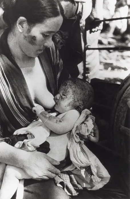 Framed Print : Mother nursing her baby after surviving of the Nagasaki atomic bomb. Japan, August 10, 1945. Photo by Yosuke Yamahata. World War 2. (BSLOC_2014_6_94) Framed Print : Mother nursing her baby after surviving of the Nagasaki atomic bomb. Japan, August 10, 1945. Photo by Yosuke Yamahata. World War 2. (BSLOC_2014_6_94)