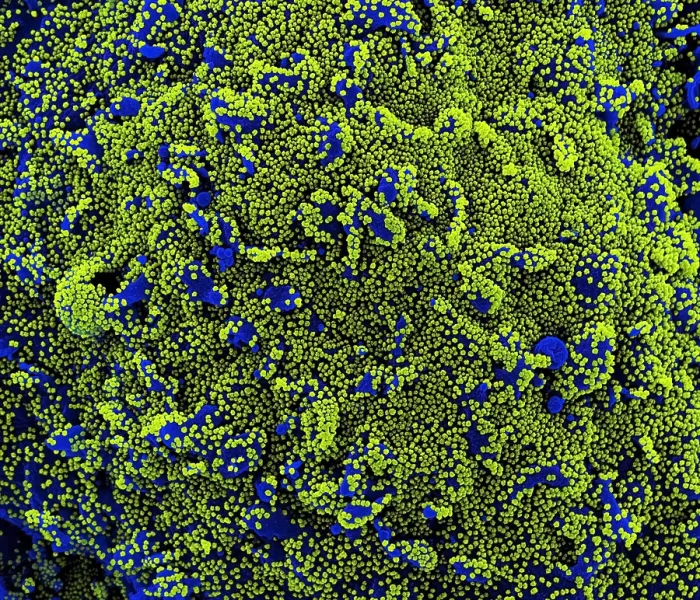 Framed Print : Novel Coronavirus SARS-CoV-2 Framed Print : Novel Coronavirus SARS-CoV-2