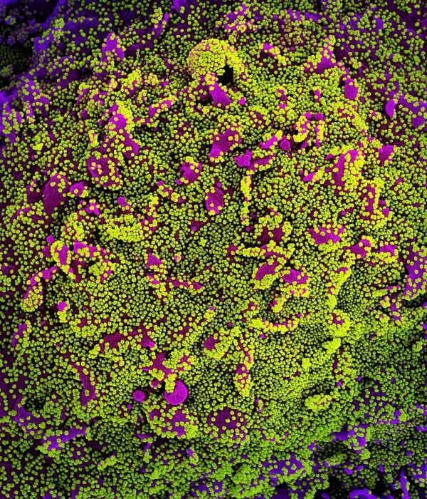 Framed Print : Novel Coronavirus SARS-CoV-2 Framed Print : Novel Coronavirus SARS-CoV-2