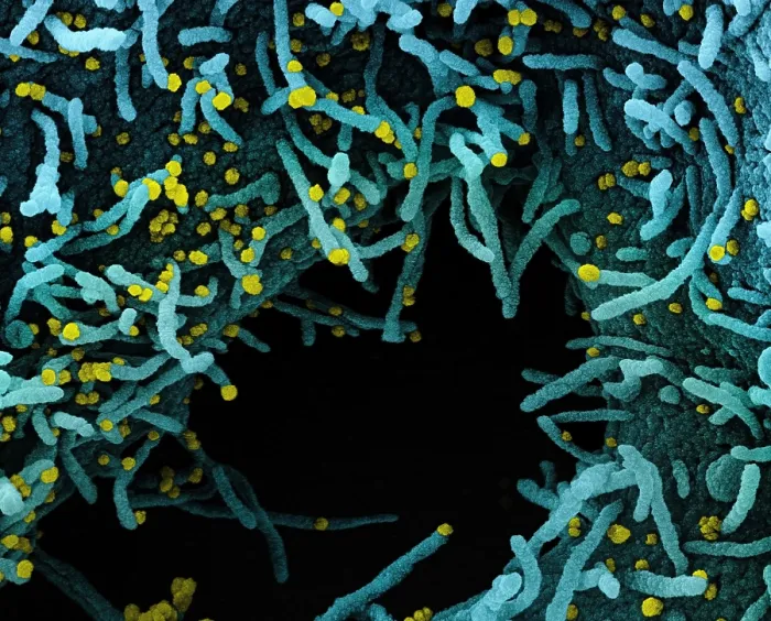 Framed Print : Novel Coronavirus SARS-CoV-2 Framed Print : Novel Coronavirus SARS-CoV-2