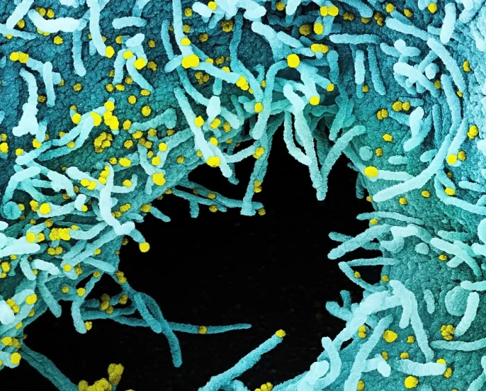 Framed Print : Novel Coronavirus SARS-CoV-2