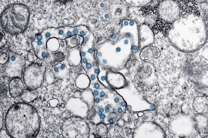 Framed Print : Novel Coronavirus SARS-CoV-2, also called, severe acute respiratory syndrome coronavirus 2, causes coronavirus disease-2019, abbreviated as COVID-19