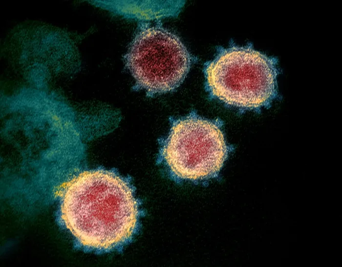 Framed Print : Novel Coronavirus SARS-CoV-2, causes coronavirus disease-2019, abbreviated as COVID-19