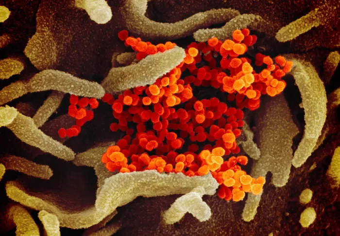 Framed Print : Novel Coronavirus SARS-CoV-2, causes coronavirus disease-2019, abbreviated as COVID-19