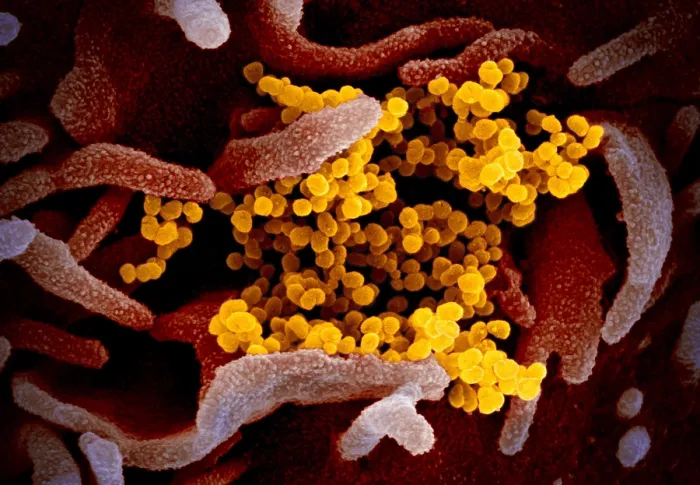 Framed Print : Novel Coronavirus SARS-CoV-2, causes coronavirus disease-2019, abbreviated as COVID-19 Framed Print : Novel Coronavirus SARS-CoV-2, causes coronavirus disease-2019, abbreviated as COVID-19