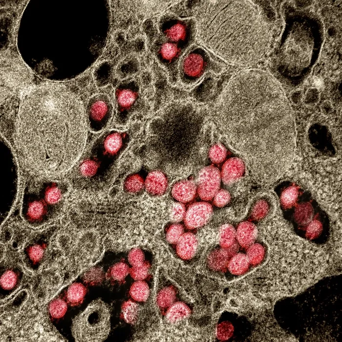 Framed Print : Novel Coronavirus SARS-CoV-2, the virus that causes COVID19 Framed Print : Novel Coronavirus SARS-CoV-2, the virus that causes COVID19