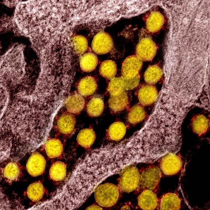 Framed Print : Novel Coronavirus SARS-CoV-2, the virus that causes COVID19 Framed Print : Novel Coronavirus SARS-CoV-2, the virus that causes COVID19