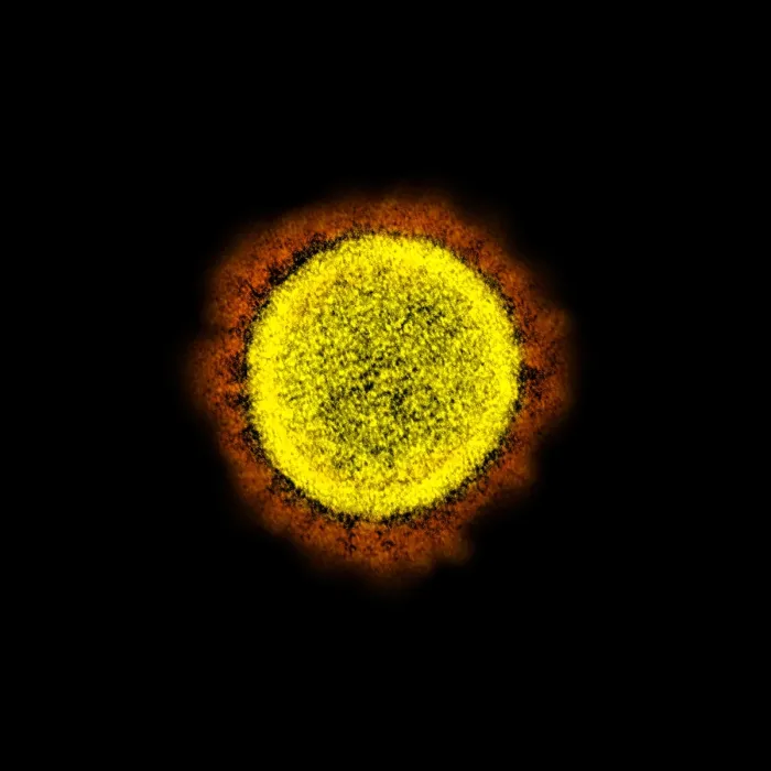 Framed Print : Novel Coronavirus SARS-CoV-2, the virus that causes COVID19. One virus particle isolated from a patient Framed Print : Novel Coronavirus SARS-CoV-2, the virus that causes COVID19. One virus particle isolated from a patient