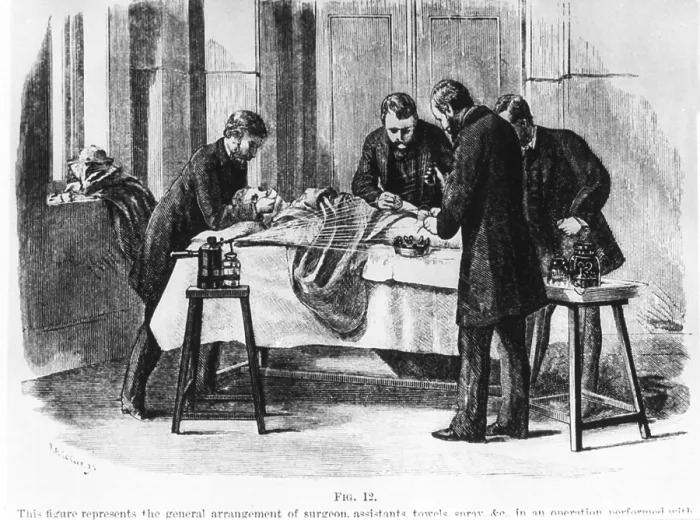 Framed Print : Operation performed with antiseptic precautions, using Lister carbolic acid spray