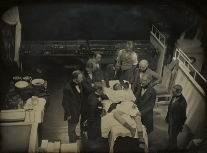 Framed Print : Operation using ether for anesthesia, a Boston's Massachusetts General Hospital, 1847. Dr