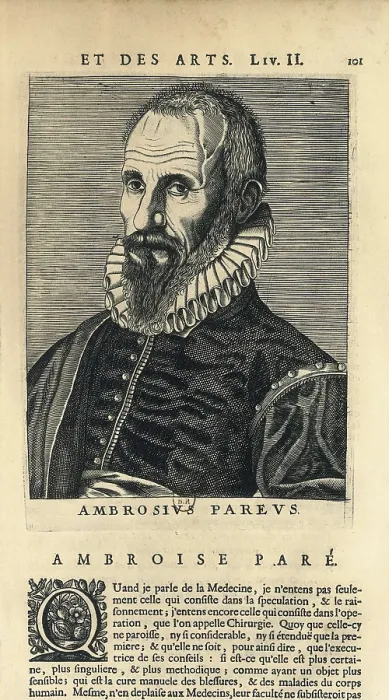 Framed Print : PARE, Ambroise (1509-1590). Xylography. FRANCE. Paris. National Library. AISA / Everett Collection**US SALES ONLY** Framed Print : PARE, Ambroise (1509-1590). Xylography. FRANCE. Paris. National Library. AISA / Everett Collection**US SALES ONLY**