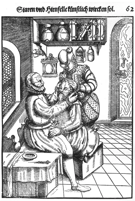 Framed Print : Patient having a cataract removed from his left eye by a surgeon whose assistant immobilizing the patient Framed Print : Patient having a cataract removed from his left eye by a surgeon whose assistant immobilizing the patient