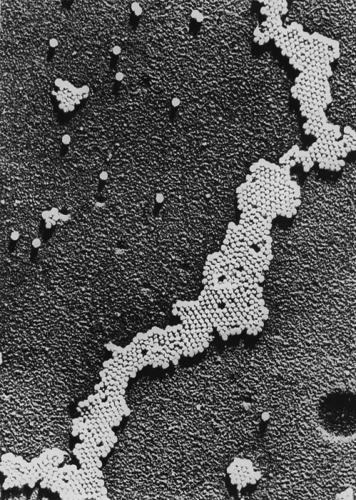 Framed Print : Polio (Poliomyelitis) virus, the cause of Infantile Paralysis, was discovered in 1908 by Karl Landsteiner