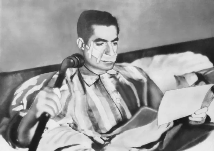 Framed Print : Shah of Iran after an assassination attempt on Feb. 4, 1949. Fakhr-Arai fired five shots from ten feet away but only grazed his check with one bullet