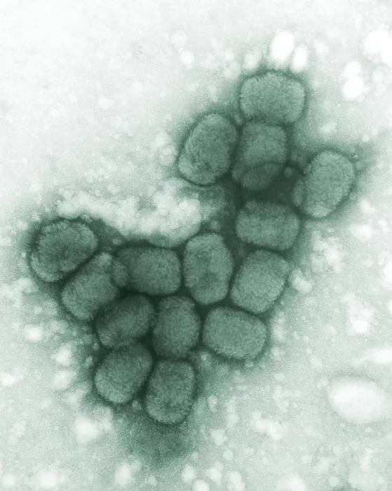 Framed Print : Smallpox viruses. A colorized transmission electron micrograph. 1975 Framed Print : Smallpox viruses. A colorized transmission electron micrograph. 1975