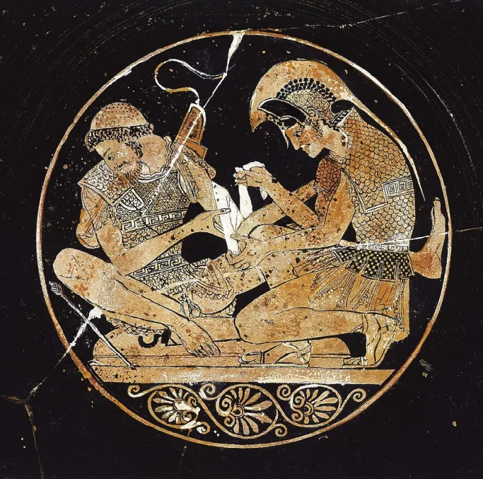 Framed Print : SOSIAS, Painter (ca. 500 BC). Vase of Sosias. ca. 500 BC. Achilles bandaging his friend Patroclus arm. Inside decoration. Archaic Greek art. Ceramics. GERMANY. Berlin