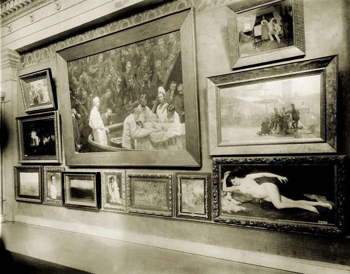 Framed Print : Thomas Eakin's monumental realist painting, THE AGNEW CLINIC (1889) is prominently displayed at the 1893 Columbian Exposition, in Chicago