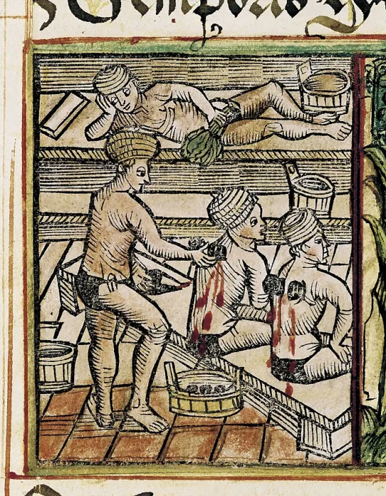 Framed Print : Tractatus de Pestilencia' by M. Albik. Application of vegetable dressings. Gothic art. Miniature Painting. CZECH Rep.. Prague. University Library