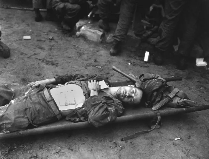 Framed Print : U.S. 21st Infantry soldier lies on a stretcher at a medical aid station