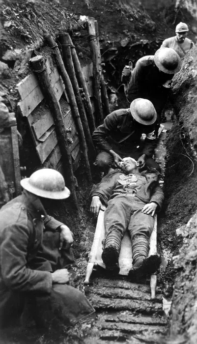 Framed Print : U.S. Marine receiving first aid in the trenches before being sent to hospital in rear. World War I, Toulon Sector, France. March 22, 1918