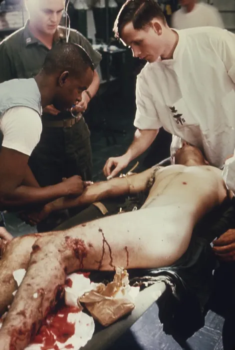 Framed Print : Vietnam War. US Marine Corporal is given treatment in the shock and resuscitation ward of the amphibious assault ship USS Tripoli Framed Print : Vietnam War. US Marine Corporal is given treatment in the shock and resuscitation ward of the amphibious assault ship USS Tripoli