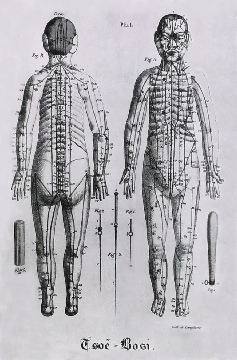 Framed Print : Front and back views of a human figure with numerous acupuncture points and meridians identified. Between the figures, but not to scale, are three acupuncture needles