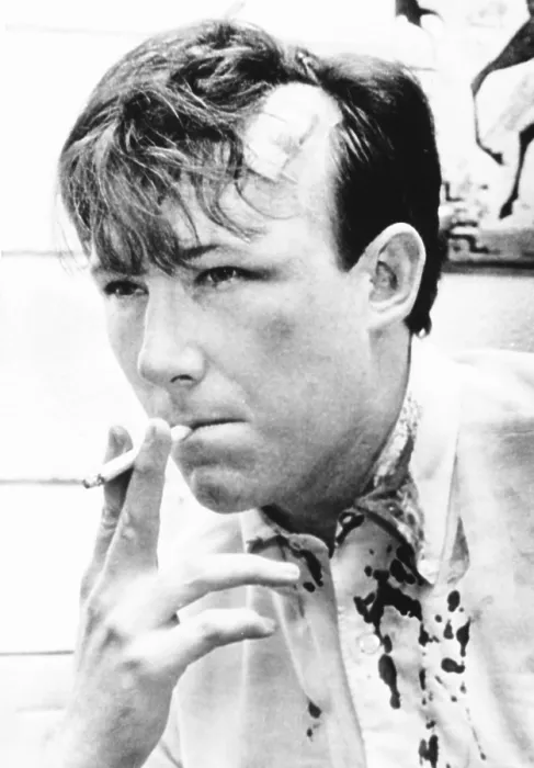 Framed Print : Washington Post reporter Jim Hoagland was beaten at South Carolina State College. Feb.10, 1968